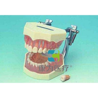 “康为医疗”可拆成人牙颌模型