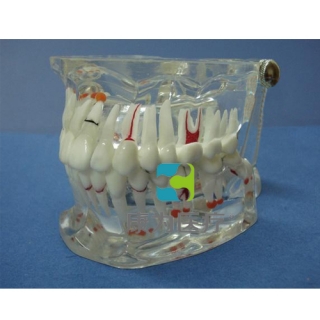 “康为医疗”综合病理水晶牙列模型(32颗牙)