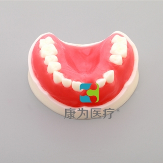“康为医疗”牙周练习模型（带骨膜）