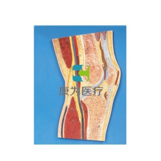 “康为医疗”膝关节剖面模型